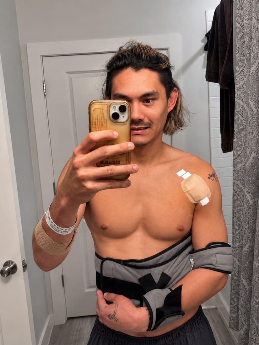 Kyle recovering from a torn pec